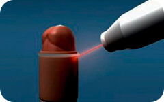 Circuncisión Láser