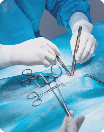 Cirugía Tradicional con bisturí